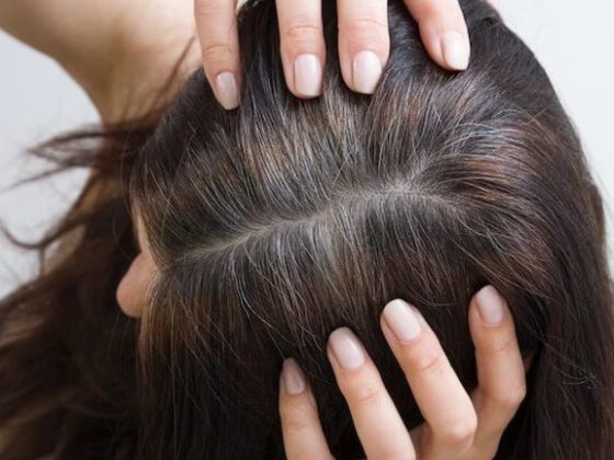 wellhealthorganic.com: know-the-causes-of-white-hair-and-easy-ways-to-prevent-it-naturally