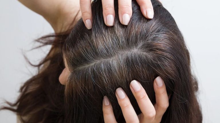 wellhealthorganic.com: know-the-causes-of-white-hair-and-easy-ways-to-prevent-it-naturally